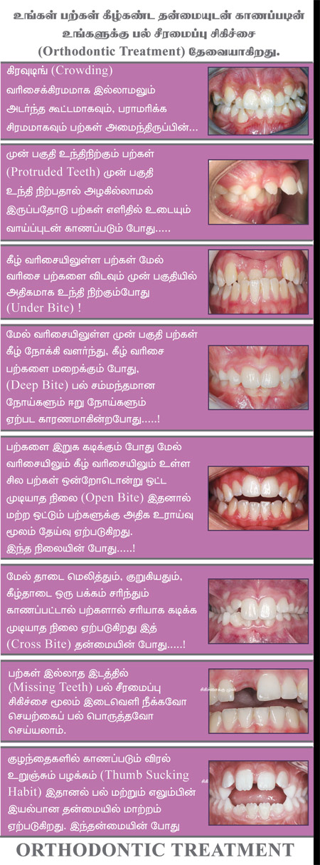 Child Dental care in kumbakonam