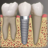Dental Clinics in Kumbakonam